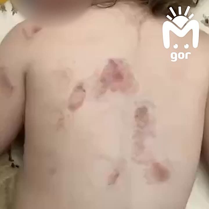 Девочку покусали в садике Дагестана, пока воспитатель куда-то пропала