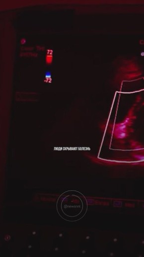 Итоги дня: сломанные судьбы, уличный преследователь, санкции по унитазам и адский Хэллоуин