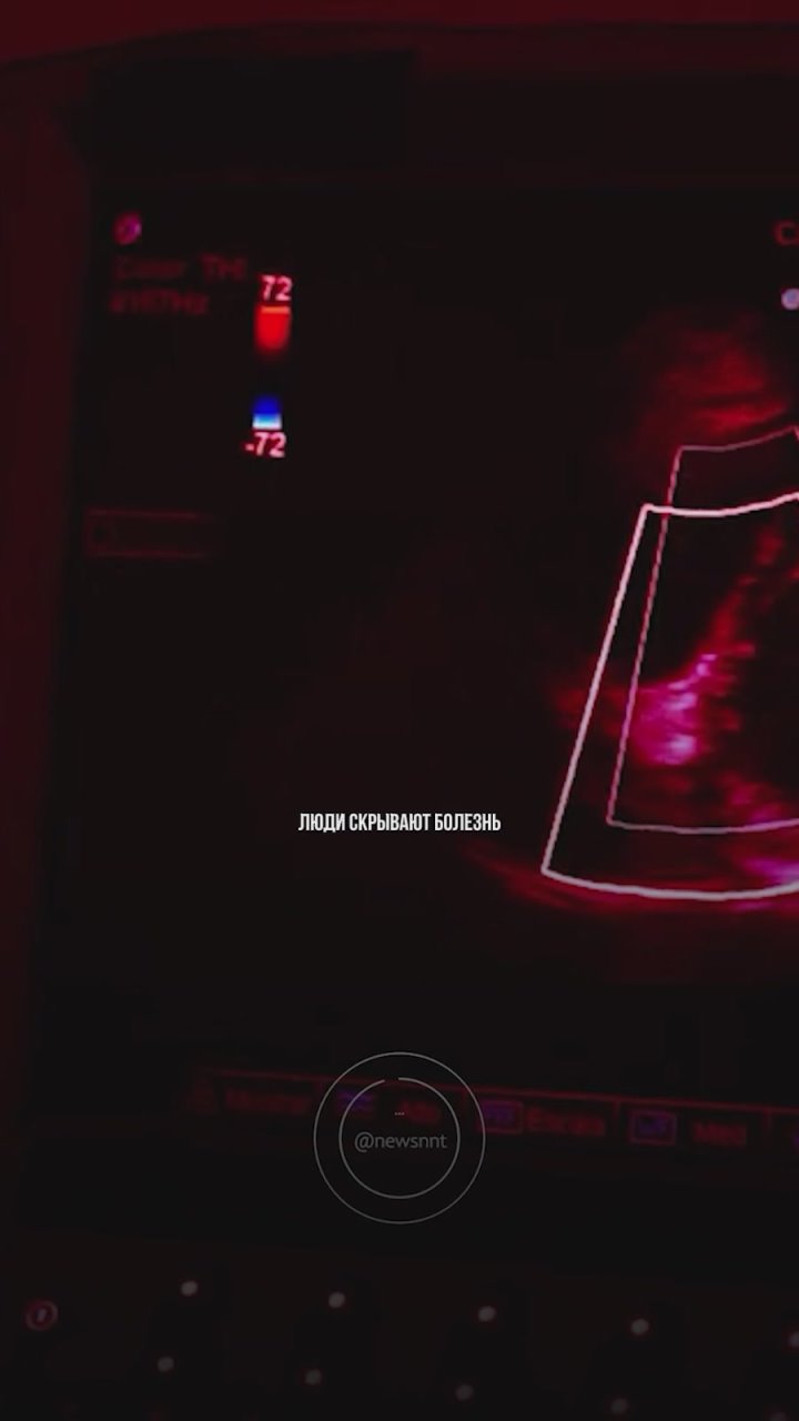 Итоги дня: сломанные судьбы, уличный преследователь, санкции по унитазам и адский Хэллоуин