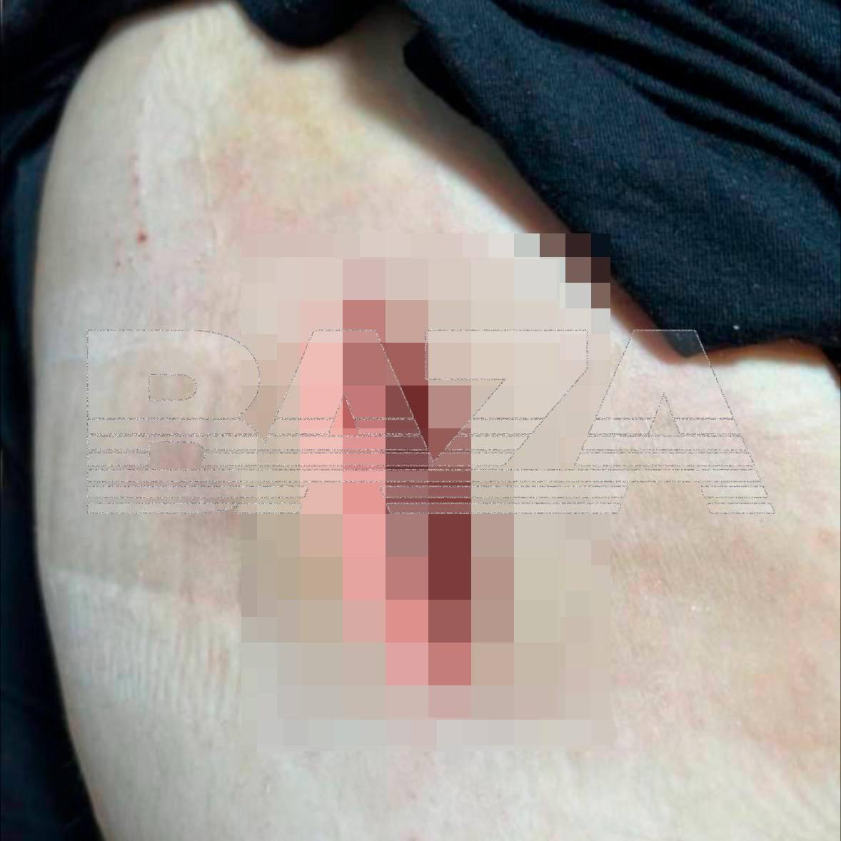 Десятки россиянок обвинили популярного косметолога в изуродованных телах после бьюти-процедур, называя её «мясником» Десятки россиянок обвинили популярного косметолога в изуродованных телах после бьюти-процедур, называя её «мясником»